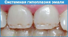 Некариозные болезни у детей (рис. 5)