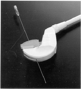 Ультразвуковая диагностика ранних послеоперационных осложнений при операциях на печени (рис. 1) Ультразвуковая диагностика ранних послеоперационных осложнений при операциях на печени (рис. 1)
