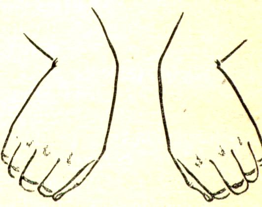 Некоторые причины возникновения профессиональных заболеваний у домристов и способы их устранения (рис. 30) Некоторые причины возникновения профессиональных заболеваний у домристов и способы их устранения (рис. 30)