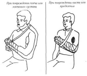 ОКАЗАНИЕ ПЕРВОЙ МЕДИЦИНСКОЙ ПОМОЩИ ПРИ ЭКСТРЕМАЛЬНЫХ ВИДАХ СПОРТА ПАРАПЛАНЕРИЗМ (рис. 13) ОКАЗАНИЕ ПЕРВОЙ МЕДИЦИНСКОЙ ПОМОЩИ ПРИ ЭКСТРЕМАЛЬНЫХ ВИДАХ СПОРТА ПАРАПЛАНЕРИЗМ (рис. 13)