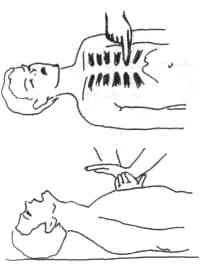 ОКАЗАНИЕ ПЕРВОЙ МЕДИЦИНСКОЙ ПОМОЩИ ПРИ ЭКСТРЕМАЛЬНЫХ ВИДАХ СПОРТА ПАРАПЛАНЕРИЗМ (рис. 17) ОКАЗАНИЕ ПЕРВОЙ МЕДИЦИНСКОЙ ПОМОЩИ ПРИ ЭКСТРЕМАЛЬНЫХ ВИДАХ СПОРТА ПАРАПЛАНЕРИЗМ (рис. 17)