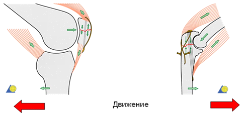 Расчет характеристик имплантата для лечения поперечного перелома надколенника (рис. 8) Расчет характеристик имплантата для лечения поперечного перелома надколенника (рис. 8)