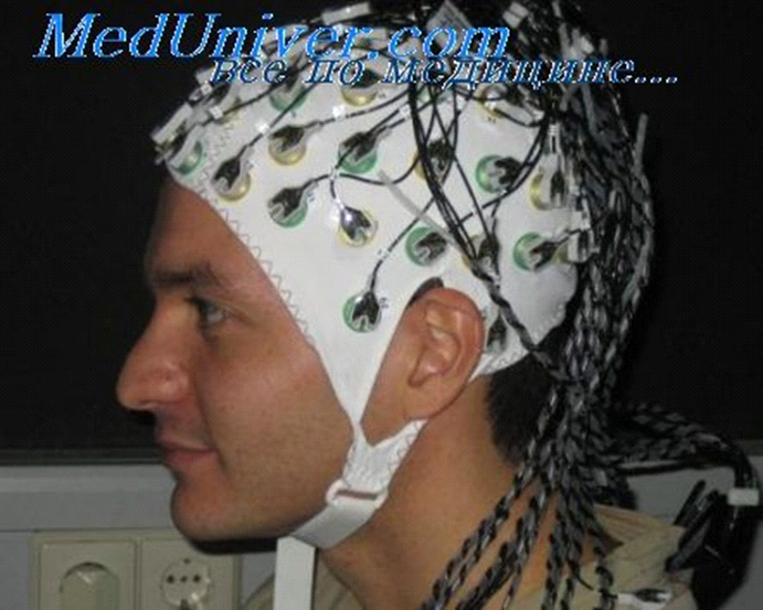 Электрическая активность центральной нервной системы. Электроэнцефалография (рис. 4) Электрическая активность центральной нервной системы. Электроэнцефалография (рис. 4)