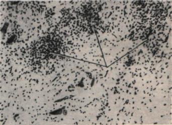 Полиомиелит: патологическая анатомия и локализация морфологических изменений в нервной системе (рис. 1) Полиомиелит: патологическая анатомия и локализация морфологических изменений в нервной системе (рис. 1)